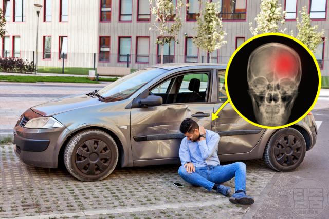 머린 다친 후 증상 구토