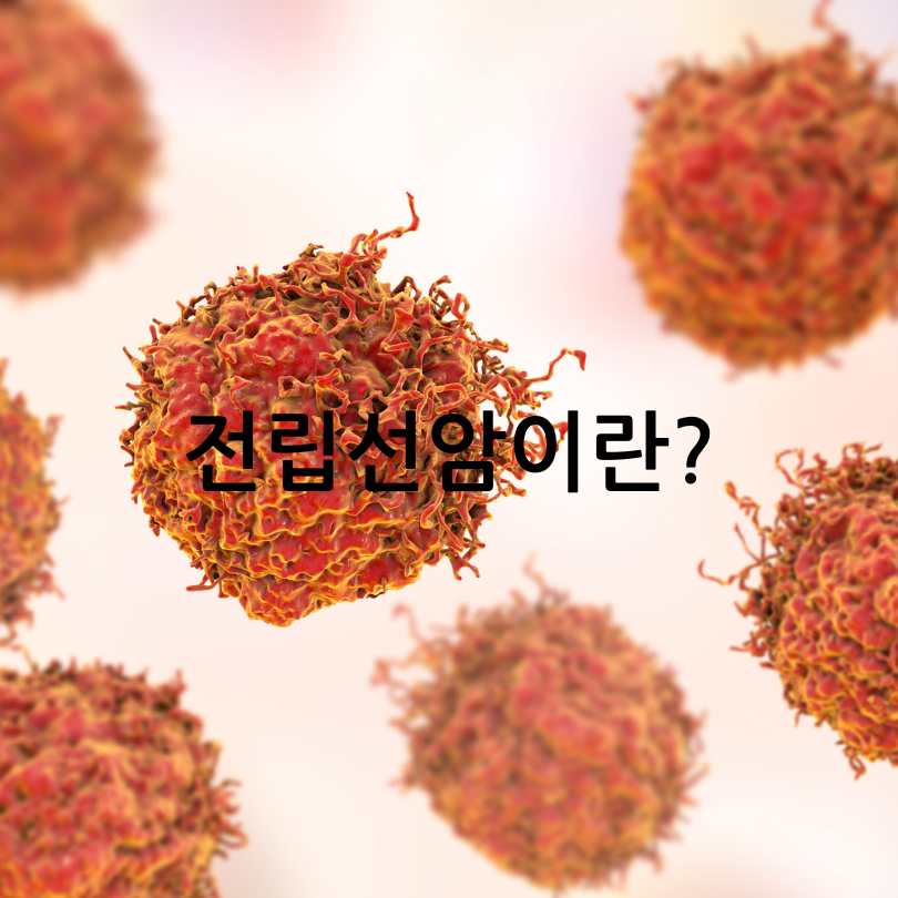 전립선암 초기증상