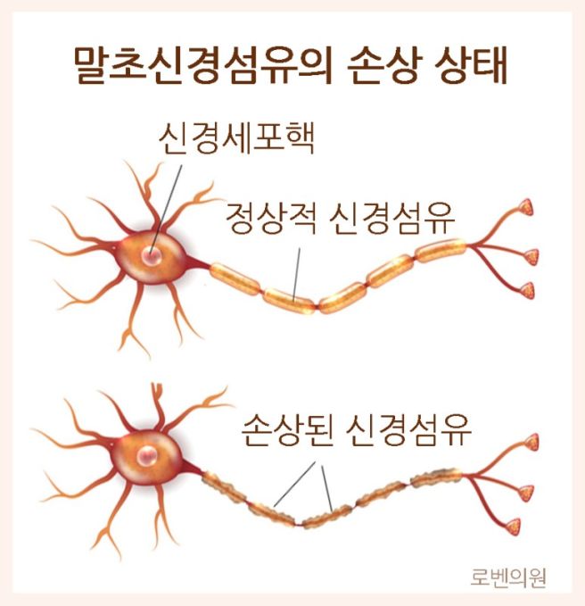 말초혈관질환 증상