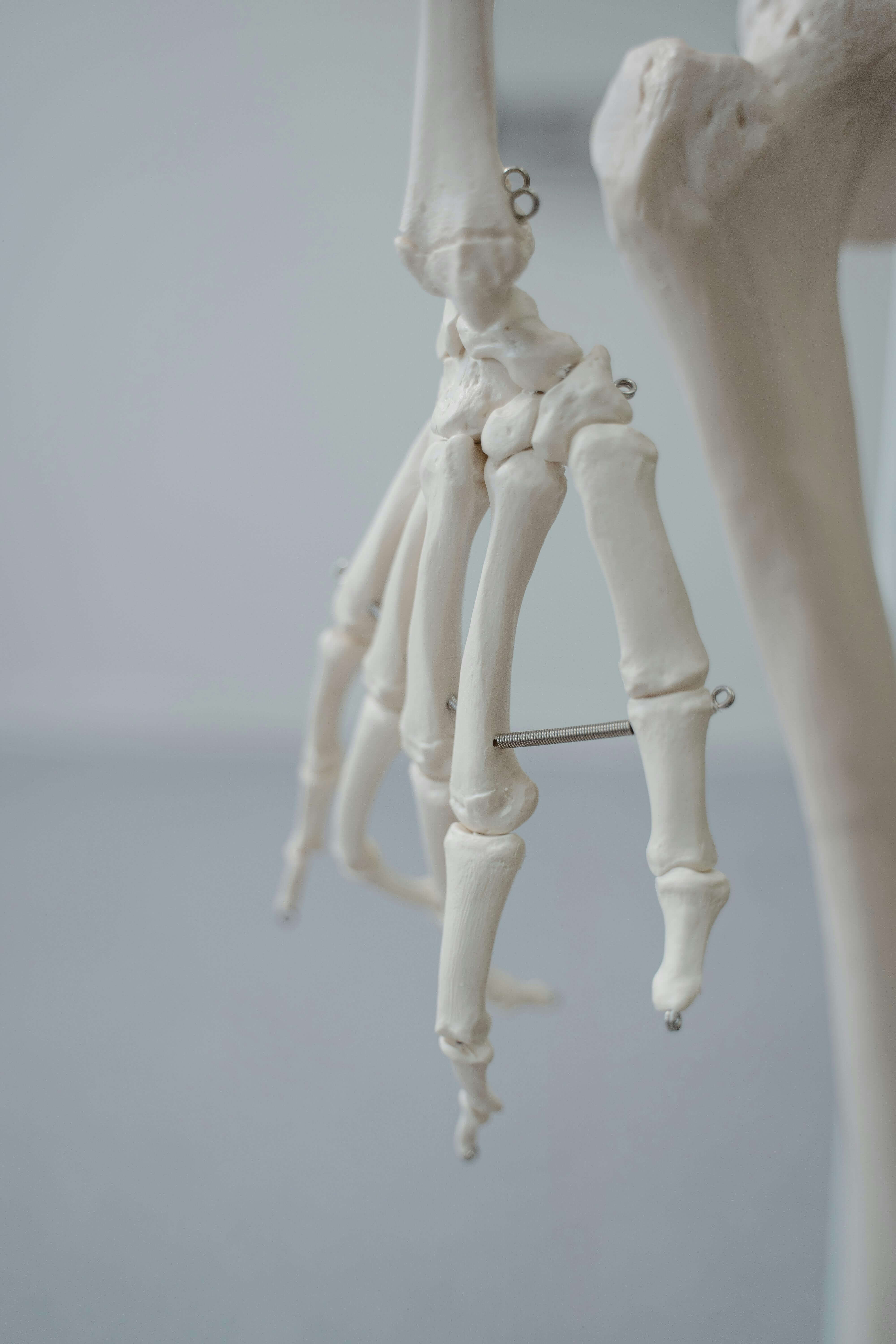 손가락 관절