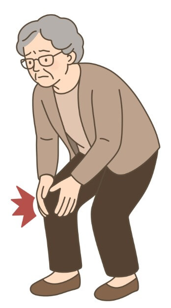 퇴행성 관절염 증상 18