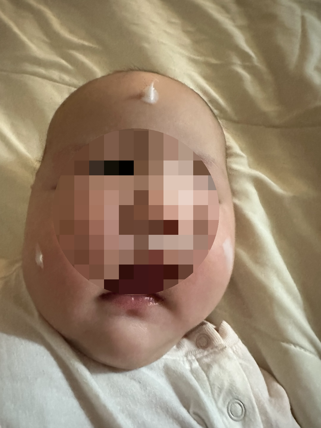 크림 바른 아이