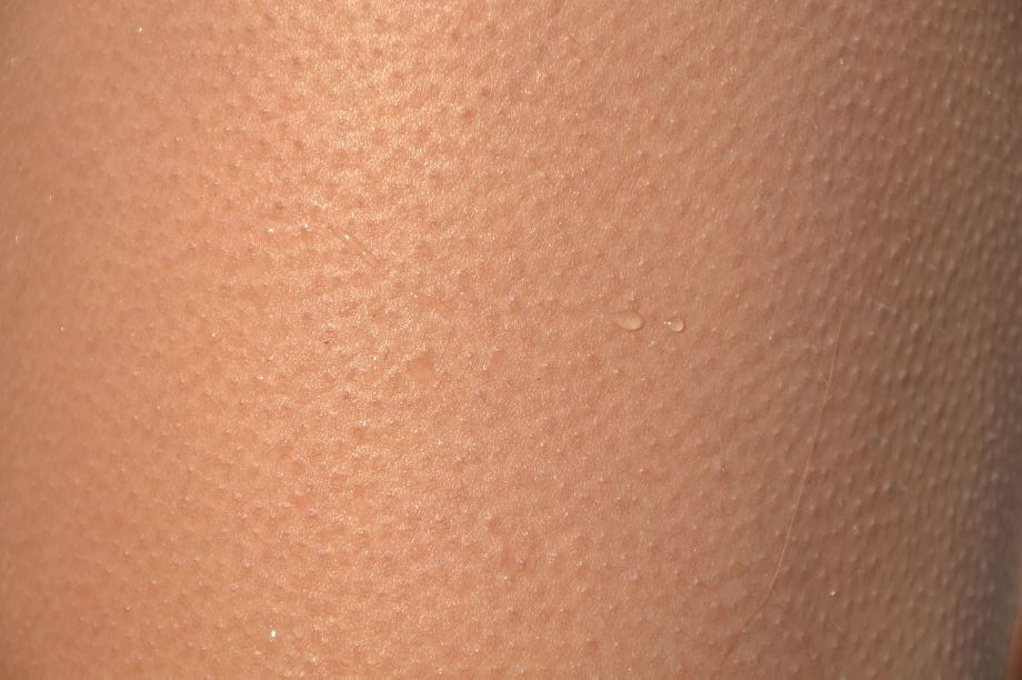 깨끗한 피부