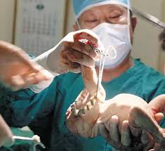 치주질환, 예방할 수 있습니다-치료