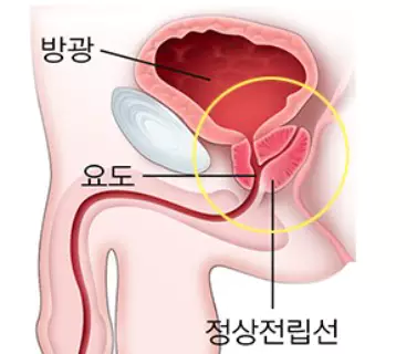 베타-시토스테롤-효능-부작용-건강