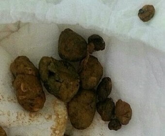 아이가-염소똥-변비에-걸려-변이-또각또각-쪼개진-모습