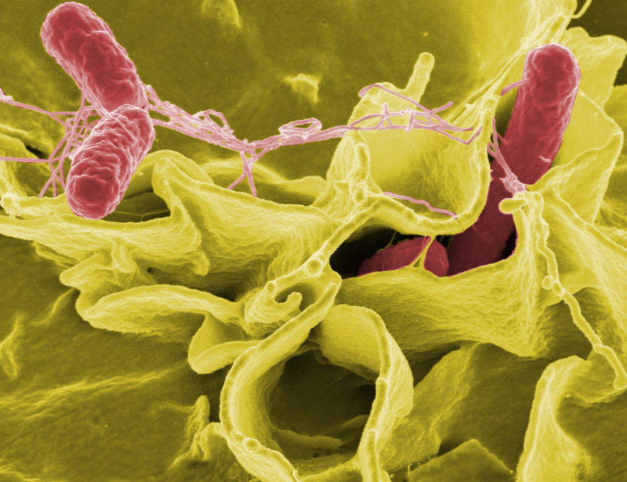 식염수 코세척 부작용
