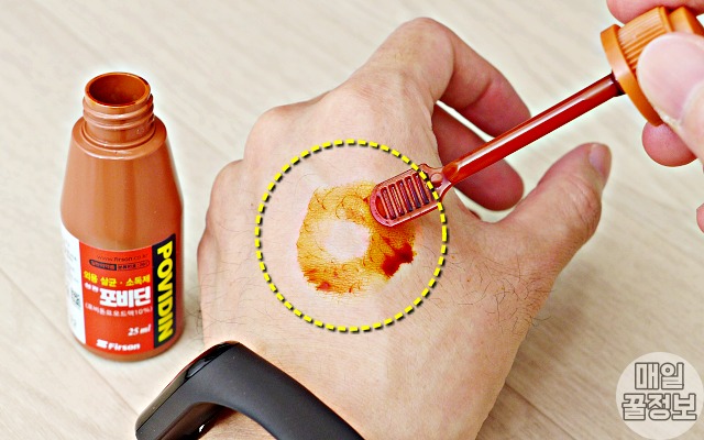 빨간약 포비돈 바르는법,빨간약 부작용,팁줌