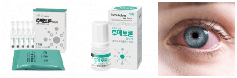 후메토론점안액, 결막염 사진