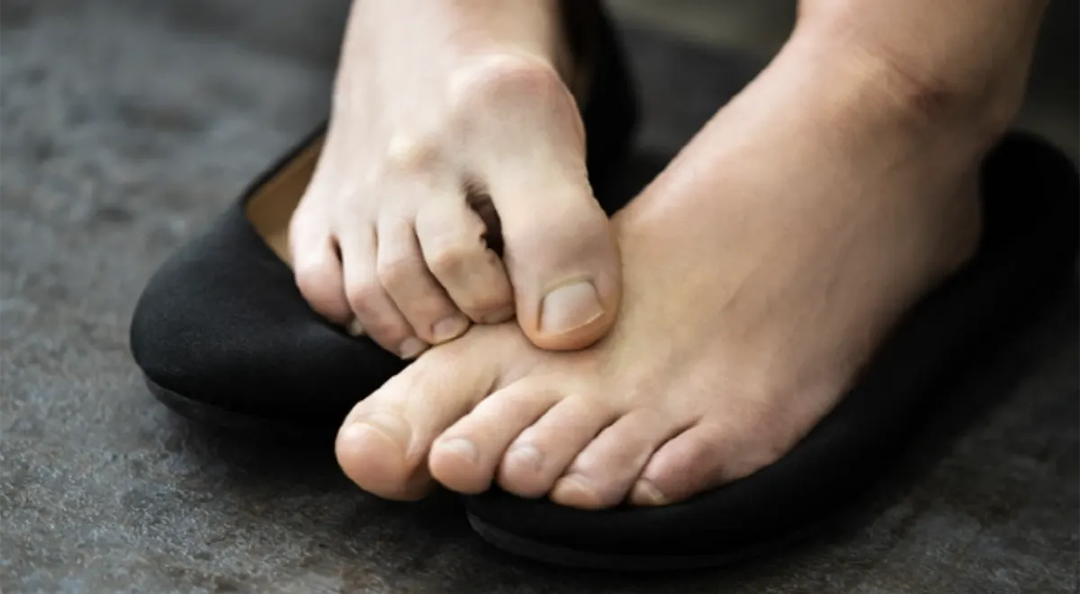 신발벗은-발-가려움