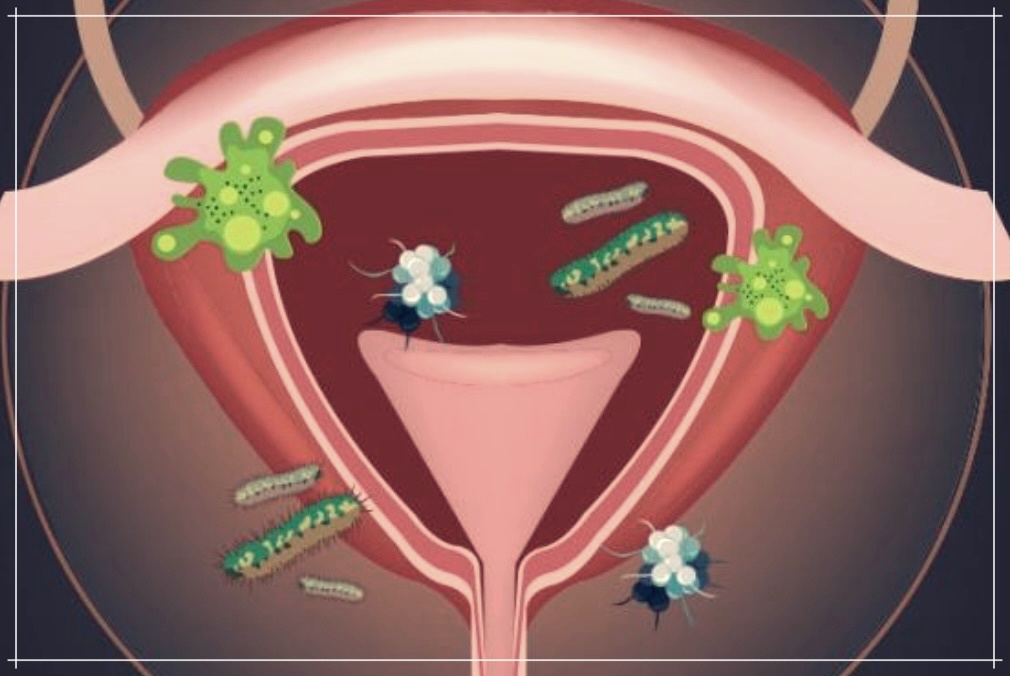 다뇨증 이란? 원인, 증상, 치료법