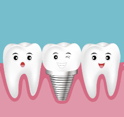 어금니 임플란트 가격