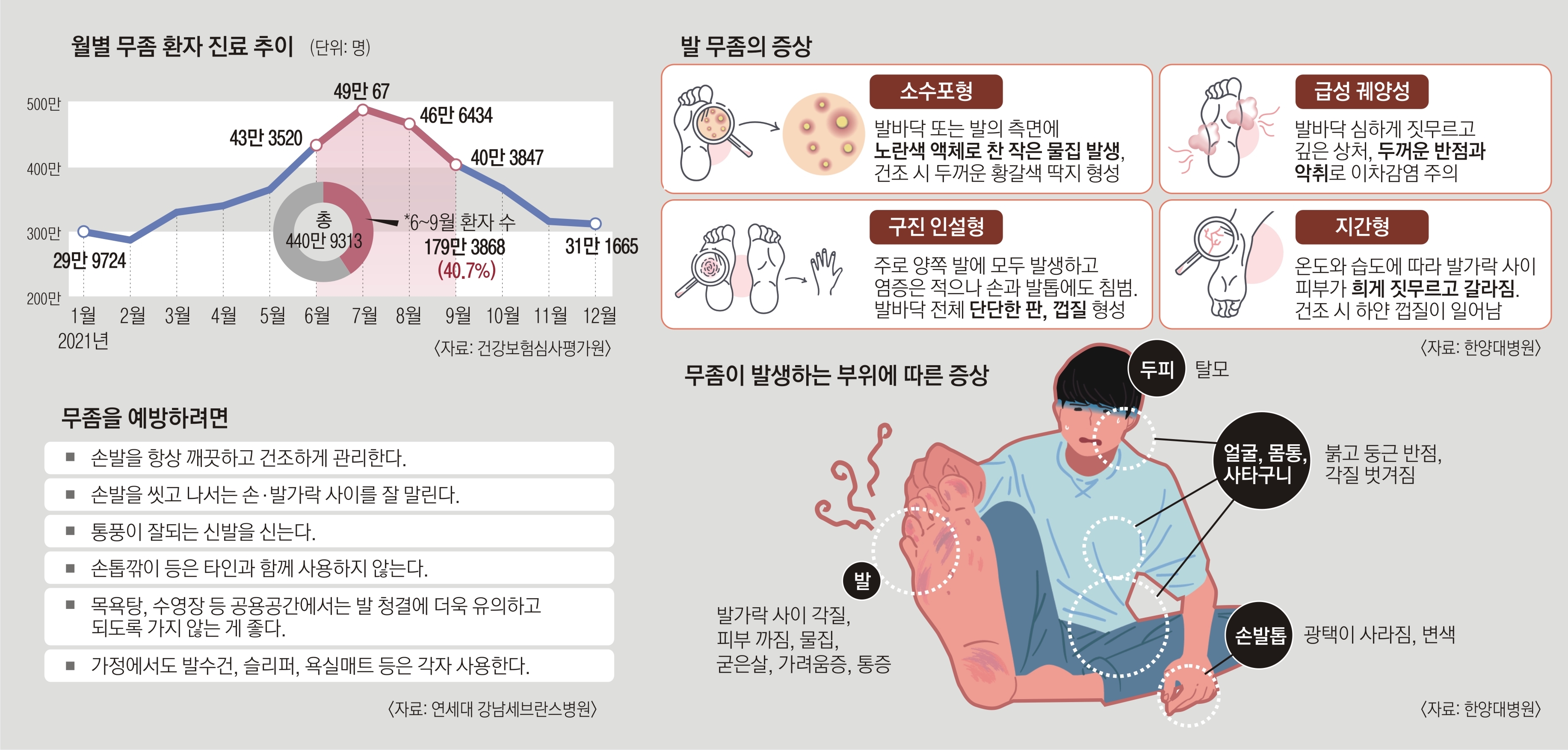 2026 발톱무좀 완치 루틴 공개｜약보다 중요한 4단계 관리법