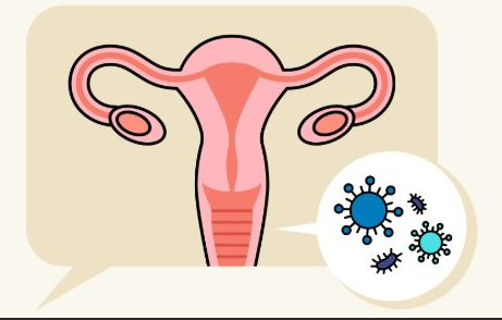 질염의원인구분