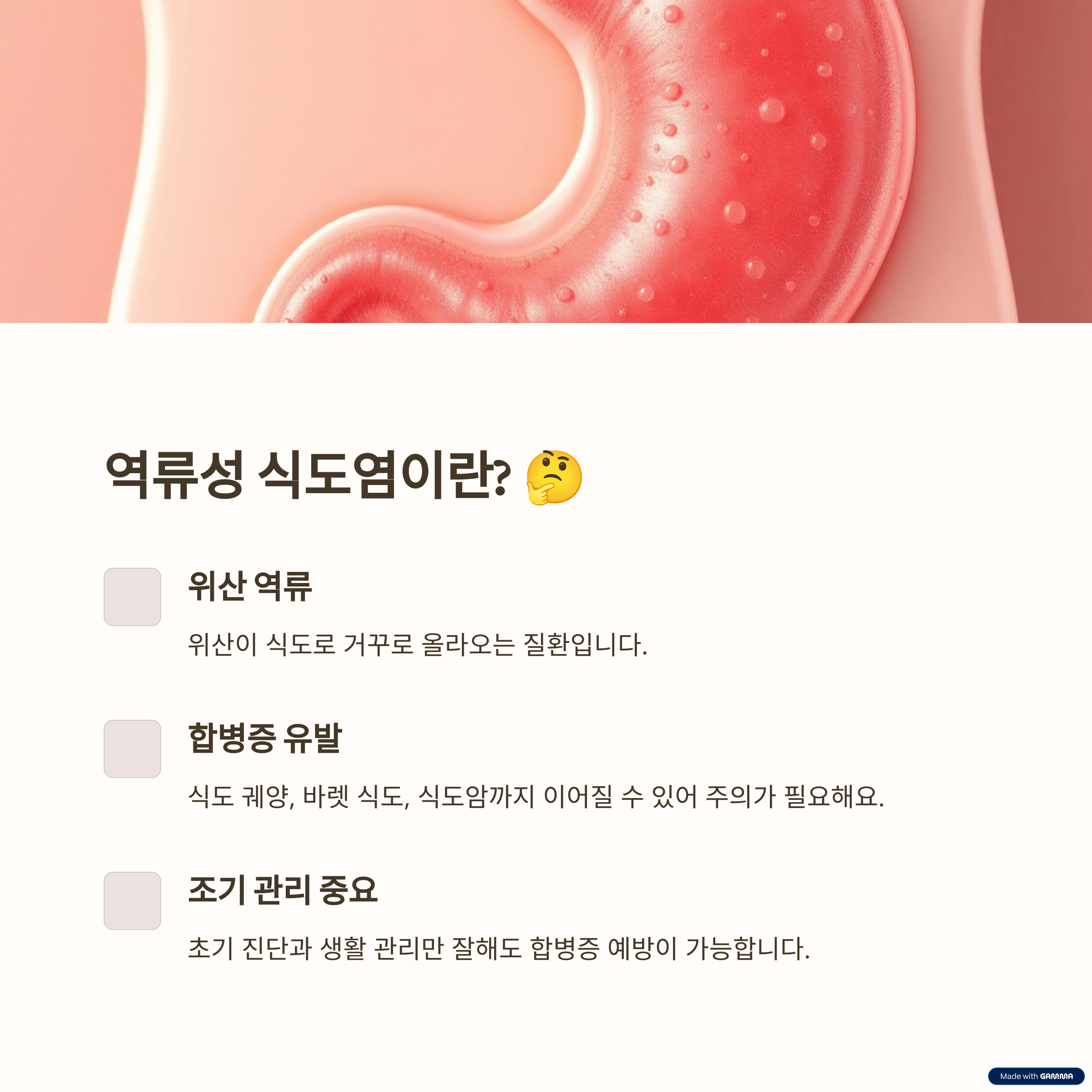 더 이상 참지 마세요! 역류성 식도염, 왜 관리해야 할까요?