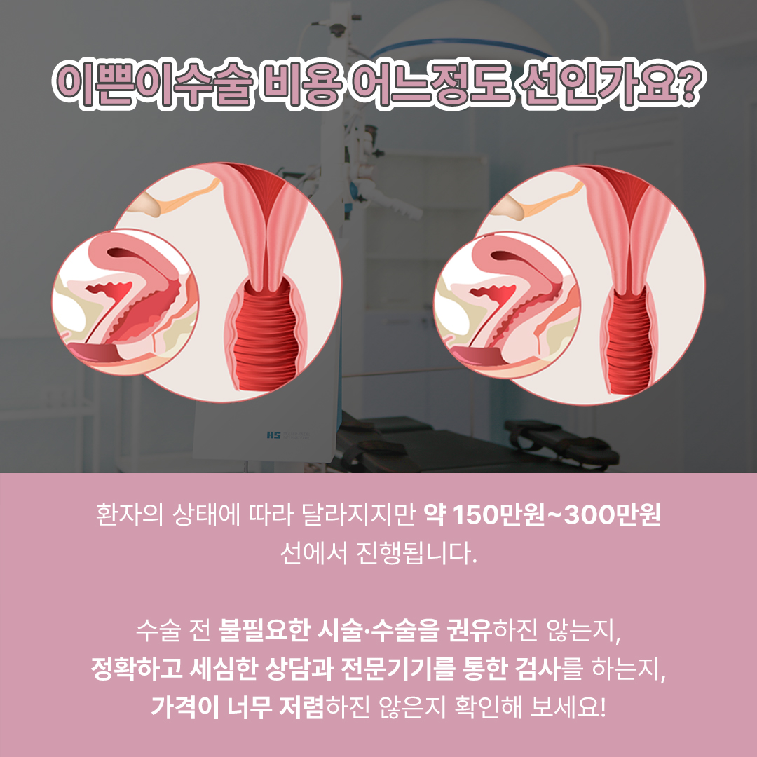 강남산부인과
이쁜이수술비용