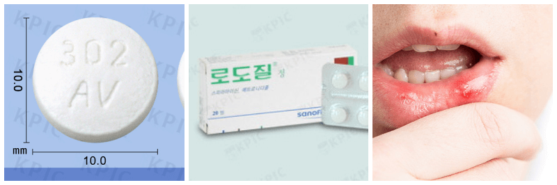 로도질정&#44; 구강염증 사진