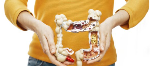 유산균 추천,프로바이오틱스