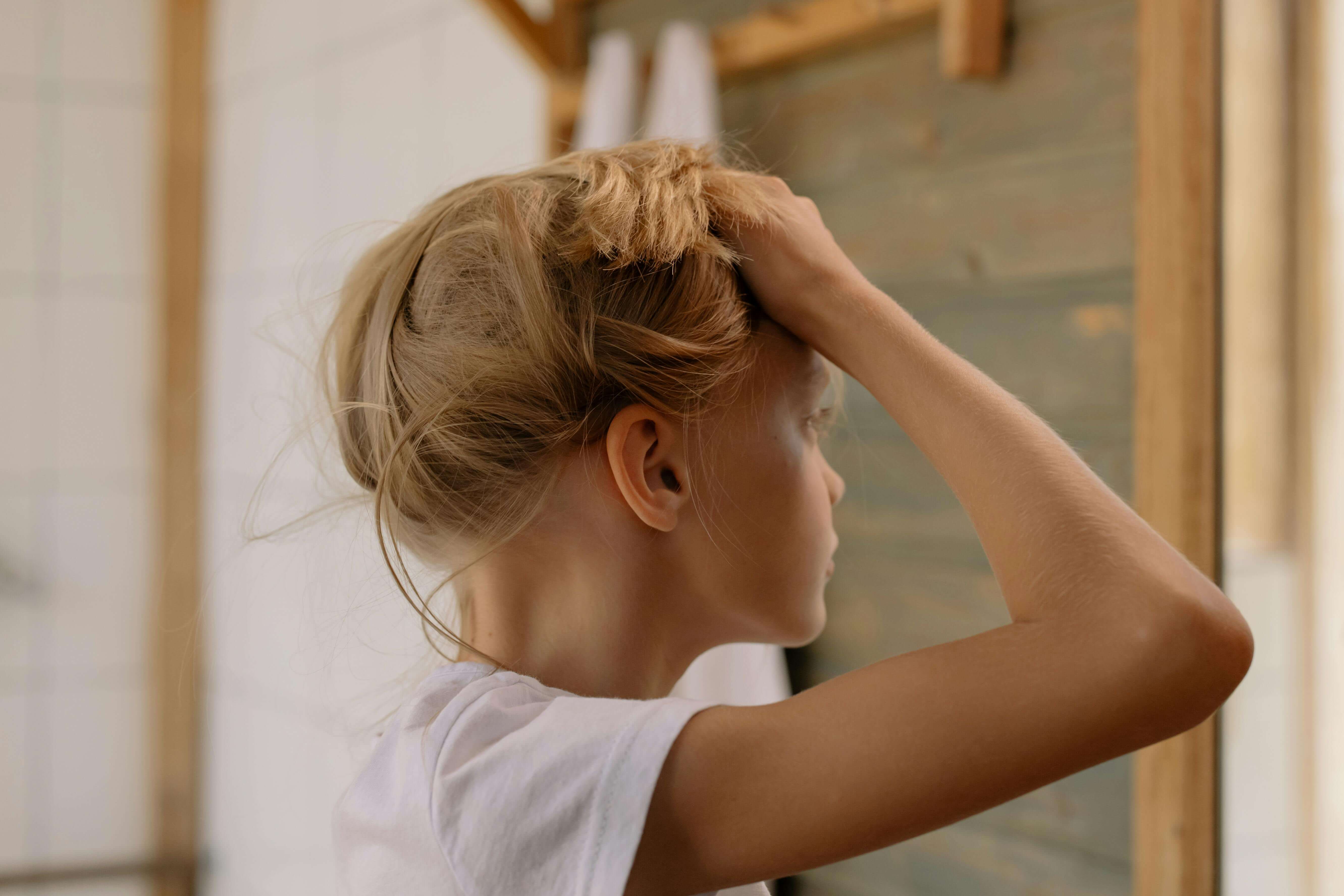 두피 건조 비듬 원인 7가지! 샴푸 바꿔도 계속 생기는 진짜 이유