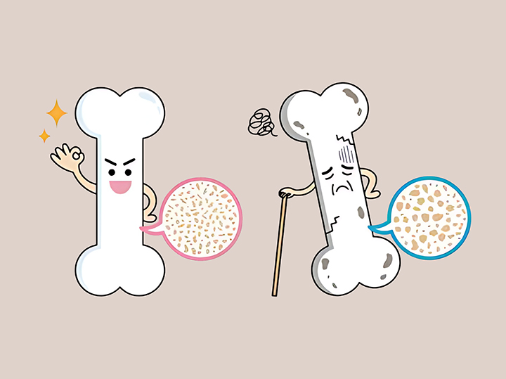 뼈-건강-및-골다공증-예방