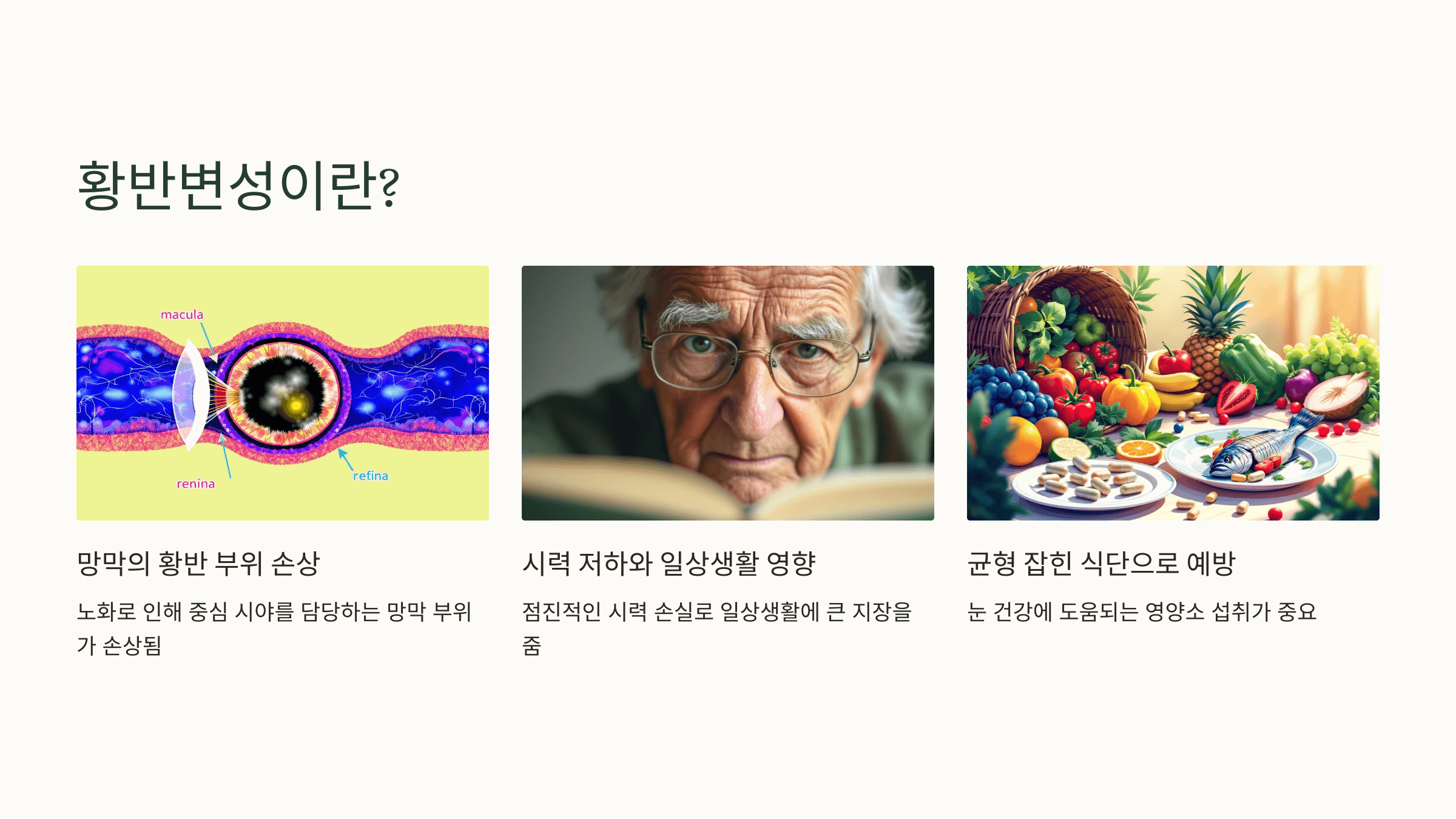 황반변성과 관련된 사진입니다.