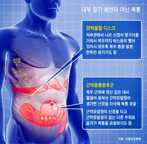 배를 콕콕 찌르는 통증의 8가지 원인 하는법 알아보기로 정리_8