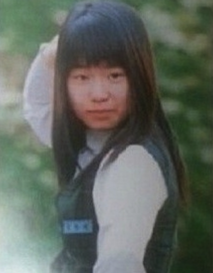 임지연 성형 전