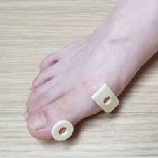 티눈이 생기는 이유