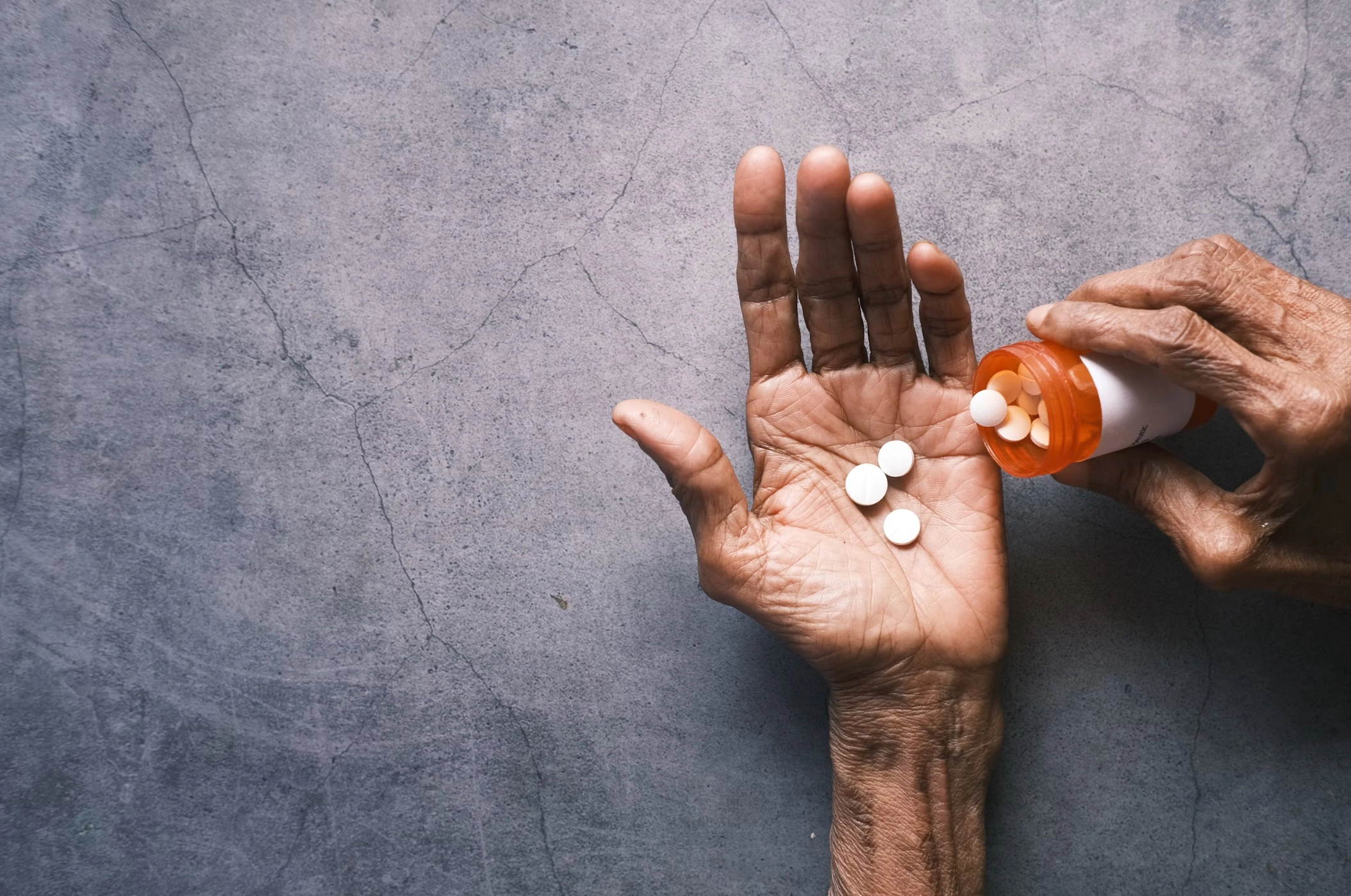 렙토스피라증 증상