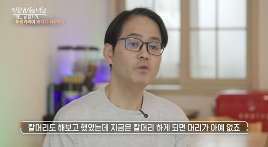 원형탈모이미지