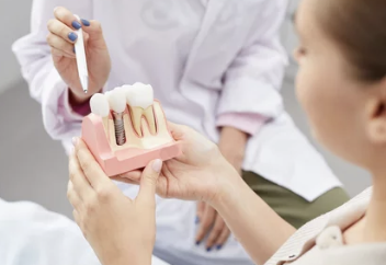 임플란트 모형 사진