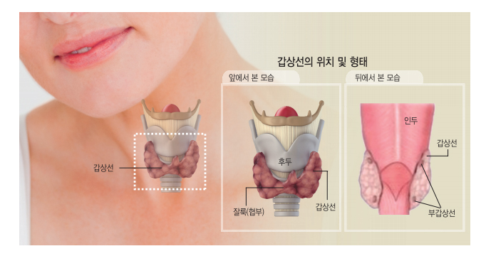 갑상선 결절 증상 및 원인과 치료 기능 저하증 수술 물혹 크기 모양 목에 혹