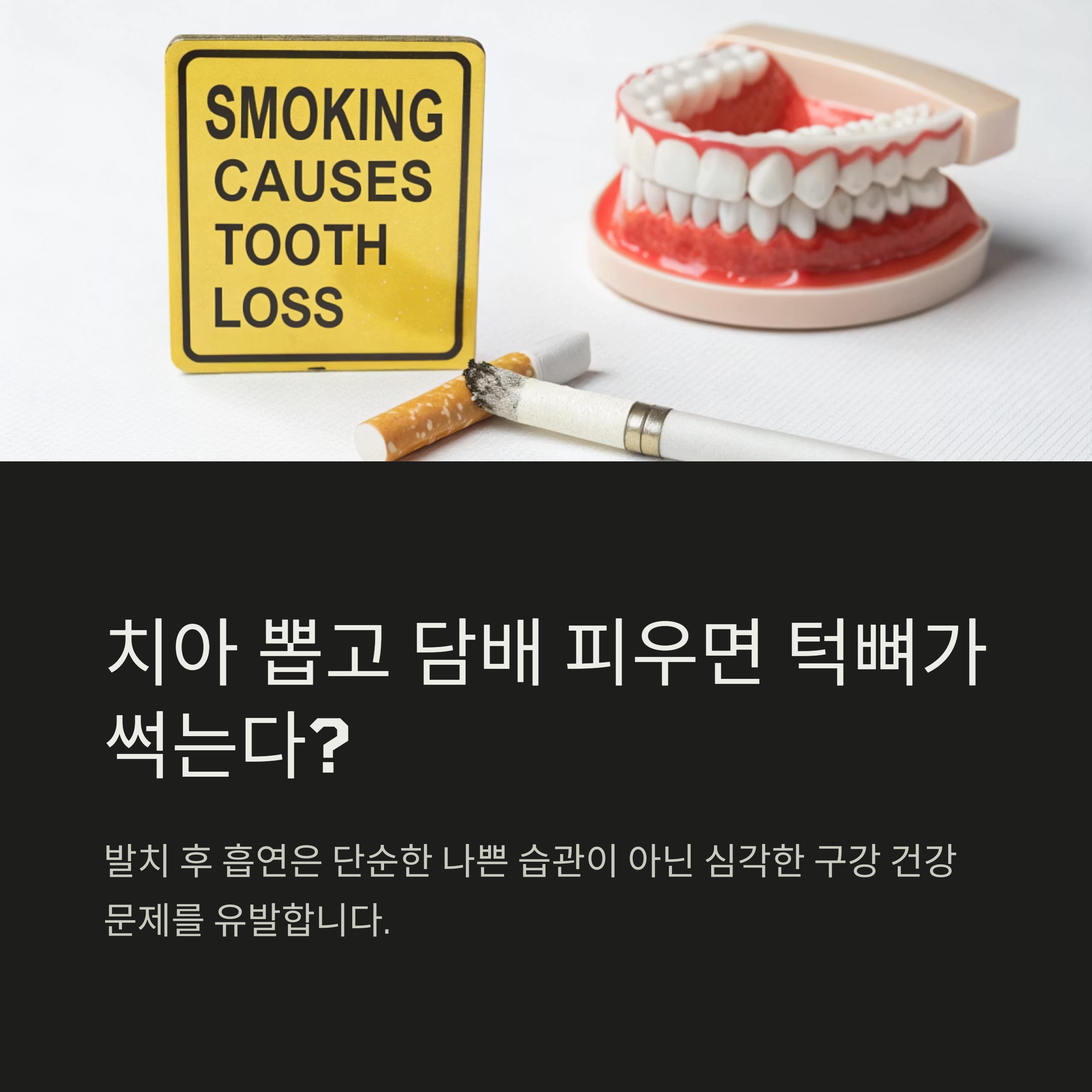 치아 발치