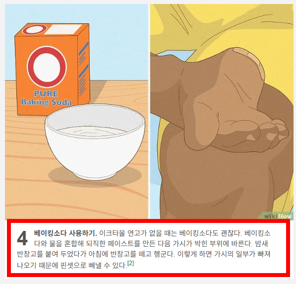 손가락 가시 빼는법 소개