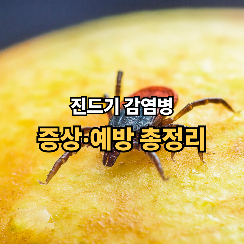 SFTS란? 여름철 진드기 감염병 ‘중증열성혈소판감소증후군’ 증상·예방 총정리
