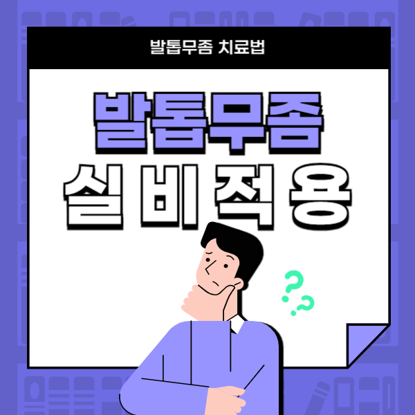 발톱무좀