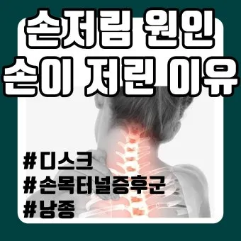 왼쪽 손이 저린 이유 완벽 건강 진단_20