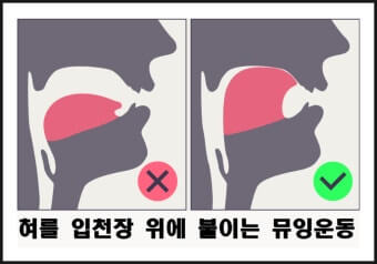 뮤잉운동으로 얼굴 갸름해지는 게 가능할까 부작용까지 정리한 과학적 분석