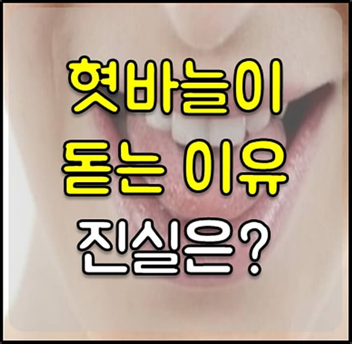 혓바늘이 돋는 이유 썸네일
