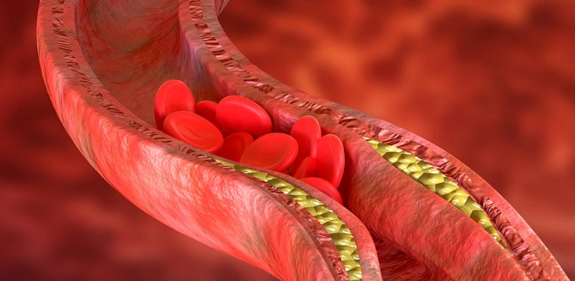 혈액순환에 좋은 음식