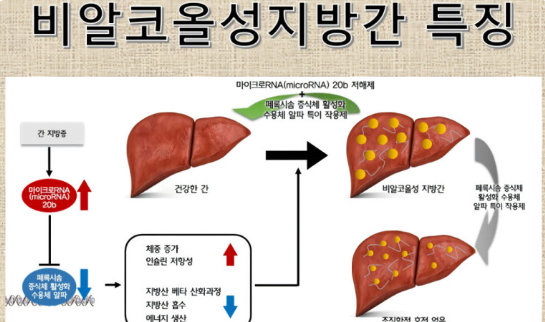 지방간의 원인부터 예방법까지 관련 이미지