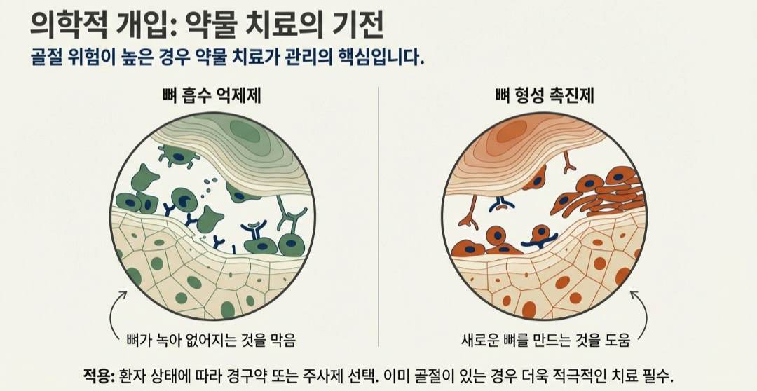 골다공증수치-사진4