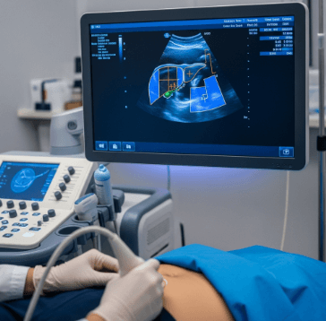 비알콜성 지방간 원인과 치료7