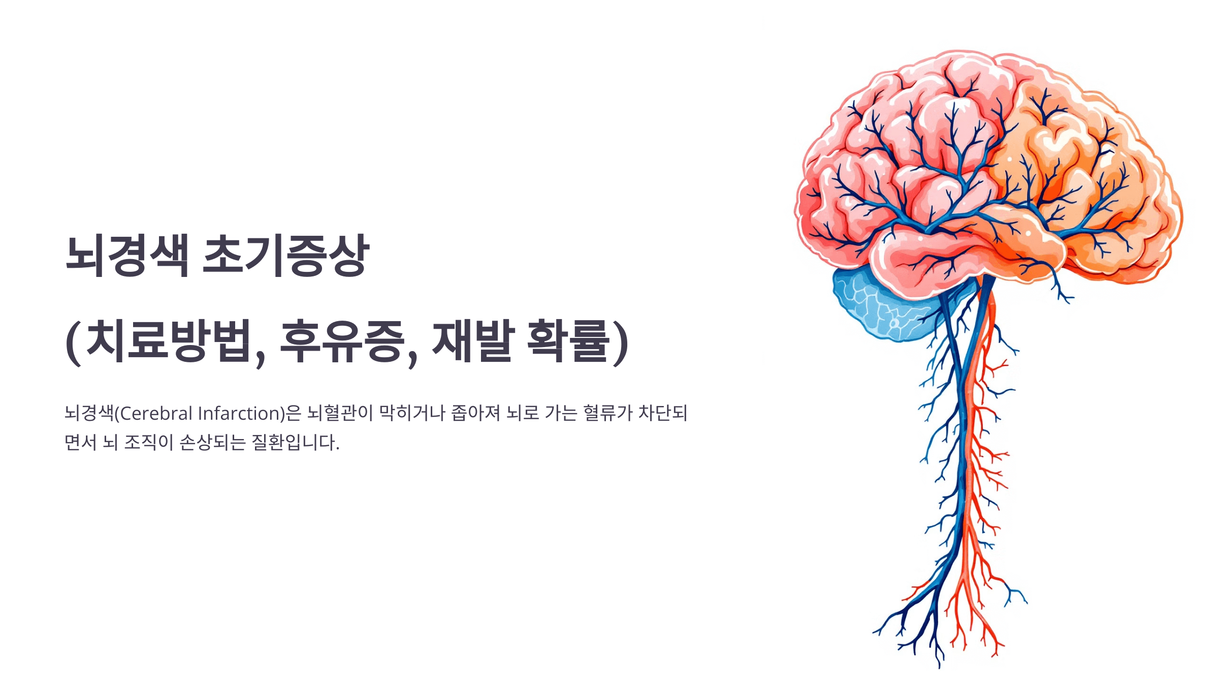 뇌경색과 관련된 사진입니다.