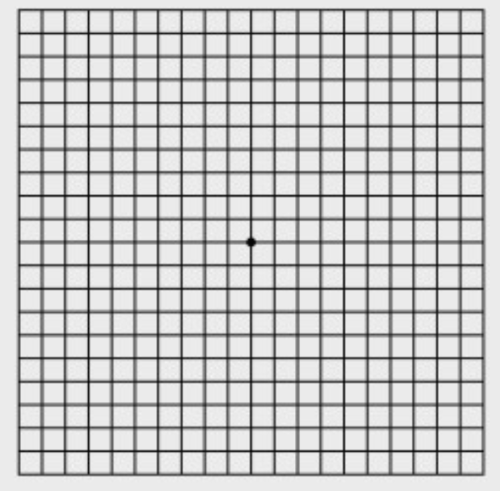 황반변성 암슬러 격자 테스트