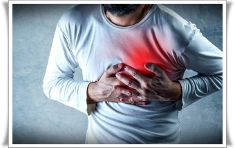 급성 심근 경색증