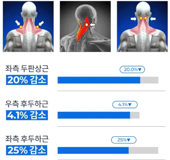 비브아 근육의 통증 자각도 개선