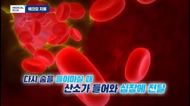 체외순환사-하는일-연봉-자격조건확인하기