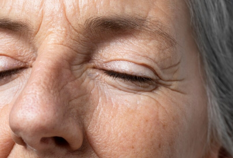 백내장이 온 할머니