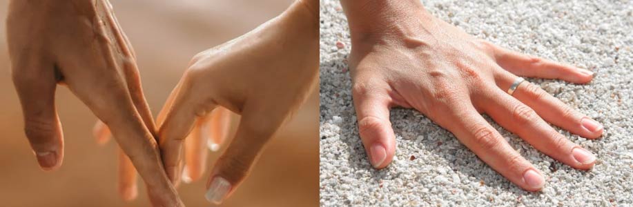 손가락에 가시 박혔을 때